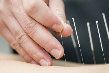 Trigger points kinesitherapie Kinemove te Lokeren